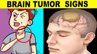 9 Warning Signs You Have A Brain Tumor - Know The Risks