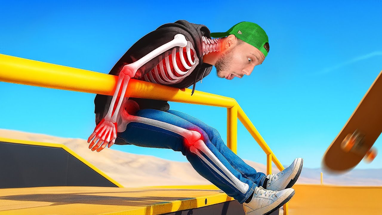 J'ai Brisé mes 206 Os en tant que Skateboarder Pro sur Skate.