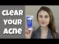 HOW TO CLEAR YOUR SKIN WITH BENZOYL PEROXIDE| DR DRAY