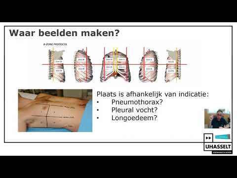 Video: Echografie liposuctie: kenmerken van de Ulfit-procedure