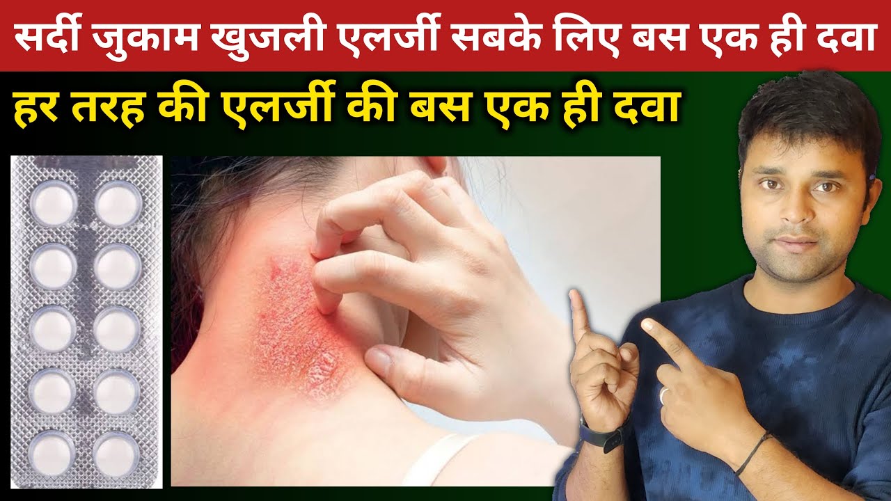 Best Medicine for Allergy | Levocet M Tablet Use Dose Composition Side Effects and Price