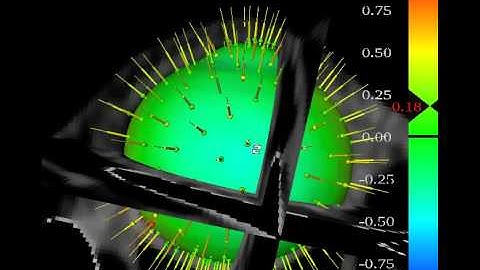 3D Statistical Shape Model of the Human Eye - Model Fitting - ARTORG Ophthalmic Technologies