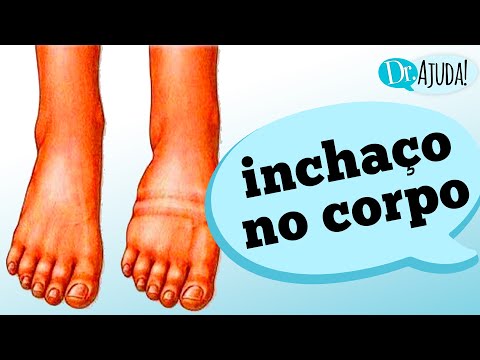 Vídeo: O que significa inchaço?