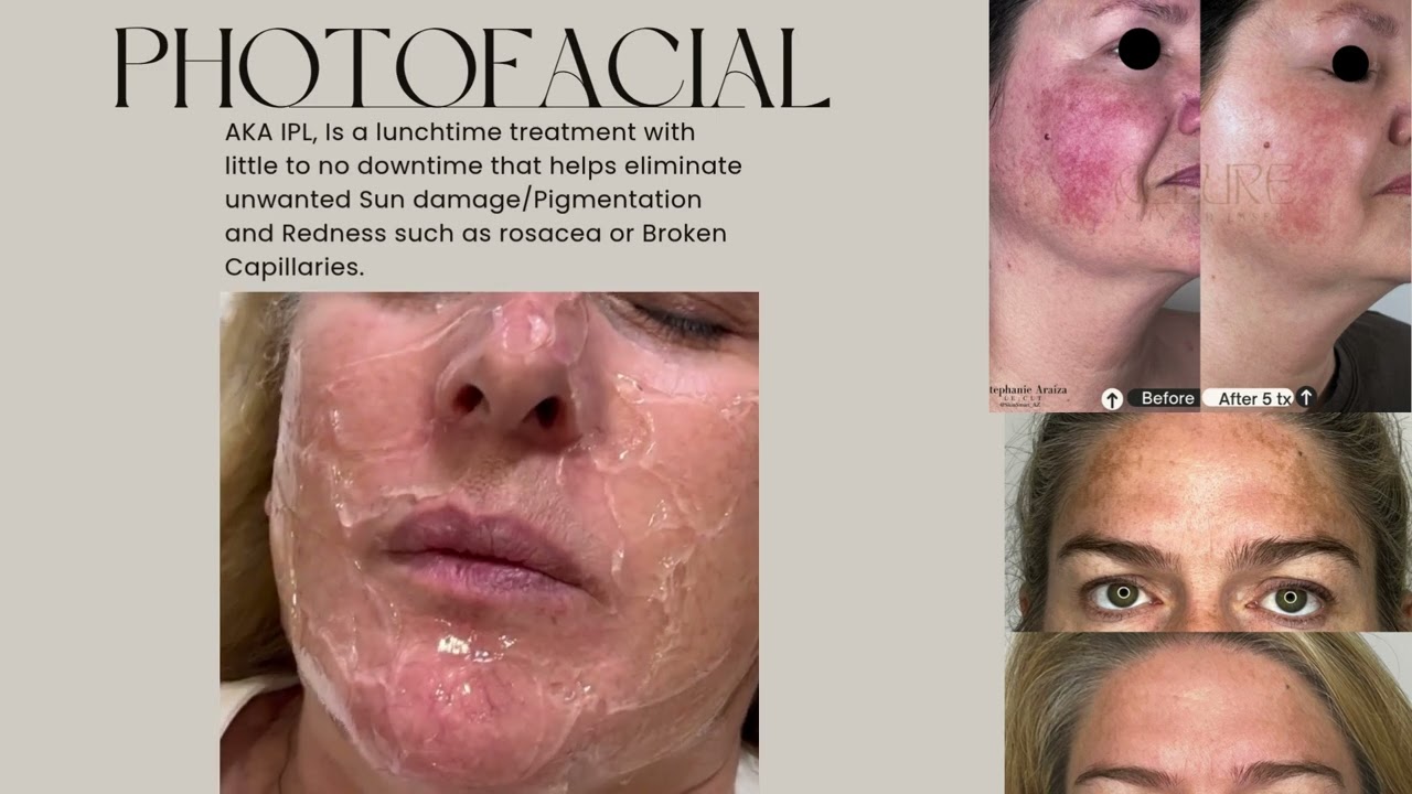 Allure Skin and Laser Queen Creek, AZ Med Spa