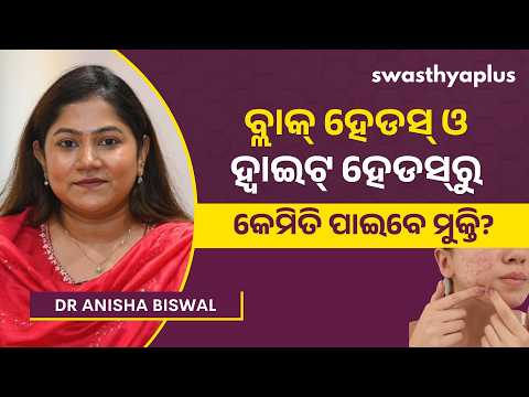 ବ୍ରଣରୁ କେମିତି ପାଇବେ ମୁକ୍ତି? |Acne/Pimples: Causes, Treatment & Prevention in Odia | Dr Anisha Biswal