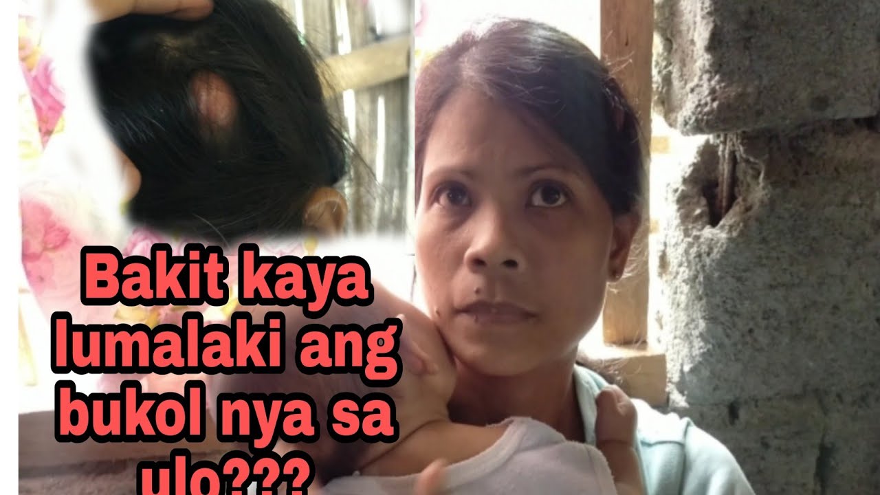 PART 1 MAY ANIM NA ANAK MAY LUMALAKI PANG BUKOL SA ULO YouTube