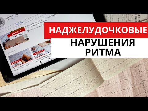 ЭКГ диагностика аритмий. Наджелудочковые (предсердные) тахикардии.