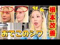 おでこのシワができる人とできない人の違い知ってる???