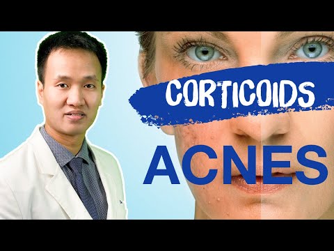Corticoids - Liệu BẠN đã HIỂU ĐÚNG về tại biến - tác dụng phụ | Dr Hiếu