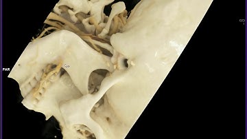 C-Spine with Cinematic Rendering