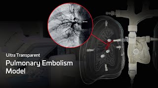 Revolutionary Pulmonary Embolism Training Model EVERY Radiologist Needs to See
