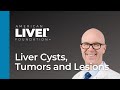 Ask the experts liver cysts tumors and lesions