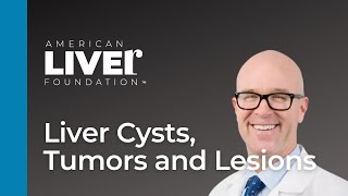 Ask the Experts: Liver Cysts, Tumors and Lesions