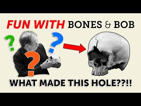 What happened to this skull? The Bone Detective investigates…