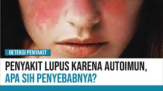 Apa Penyebab Penyakit Lupus Akibat Autoimun? | Deteksi Penyakit
