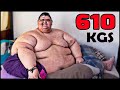 देखिये दुनिया के 10 सबसे मोटे लोग कैसे अपनी ज़िन्दगी जीतें है 10 Fattest People in The World