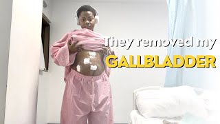 MY LAPAROSCOPIC GALLBLADDER REMOVAL SURGERY + RECOVERY