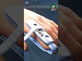 ماذا تفعل إذا كسرت أصبعك ماذا تفعل إذا كسرت أصبعك