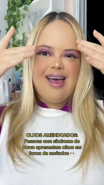 CINCO CARACTERÍSTICAS FÍSICAS DA SÍNDROME DE DOWN!