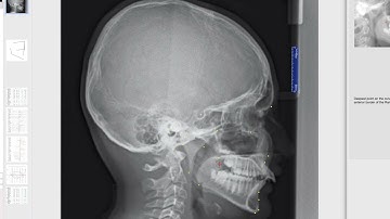 Ceph tracing with QuickCeph. Обрисовка ТРГ в QuickCeph Studio