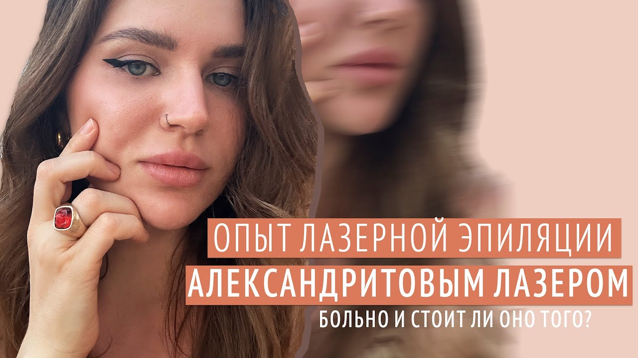 МОЙ ОПЫТ ЛАЗЕРНОЙ ЭПИЛЯЦИИ АЛЕКСАНДРИТОВЫМ ЛАЗЕРОМ | БОЛЬНО? СТОИТ ЛИ ТОГО? 🌟