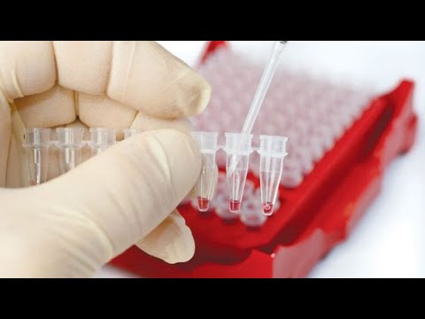 Video: Koji su leukociti odgovorni za oslobađanje histamina?