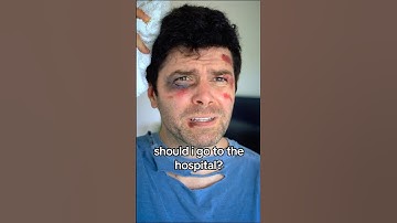 Have you ever heard of The Broken Bone Theory? Does it apply to you? Inspired by: @briannamizura