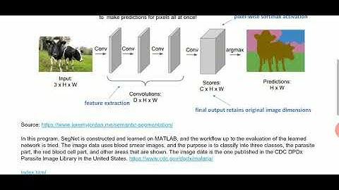 Medical Image Segmentation Using SegNet in Matlab. IP Credit in description