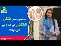 How to treat Nail Fungal Infection | Remedies | Pak Totkay