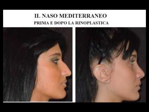 Liberare il naso chiuso velocemente e in modo naturale ...