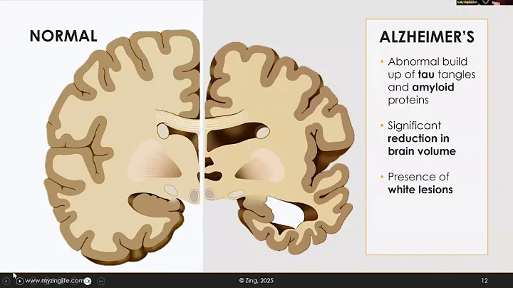 Matters of Memory: Normal Aging or Cognitive Decline