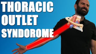 THORACIC OUTLET SYNDROME.  BEST Exercises, Stretches & Advice for Neck & Arm Pain Relief