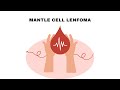 Mantle Cell Lenfoma