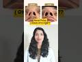 Nasal Polyp Cure Permanently #odia #health #trending #nasalpolyp