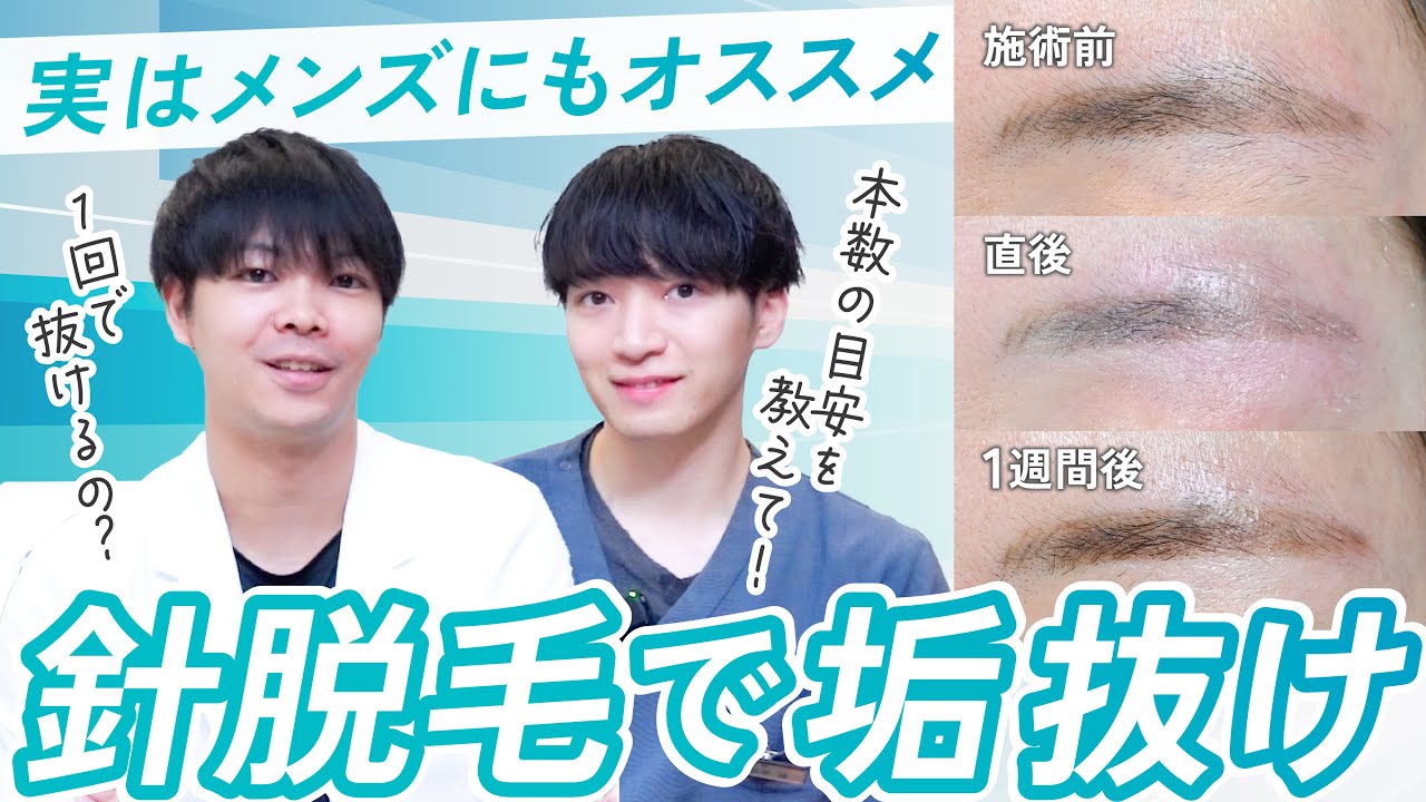 1回で抜ける？ニードル脱毛の魅力☆永久脱毛 - YouTube