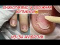 Аллергия на гель лак 🥴 Онихолизис 😱Сложная кутикула