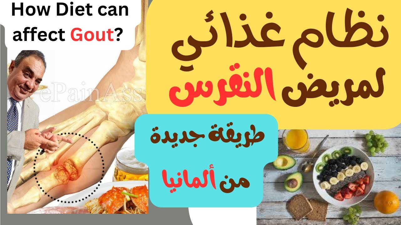 نظام اكل مرضى النقرس  | اعرف اي اكل مسموح ومفاجأة نظام تغذية يومي من ألمانيا للمرضى