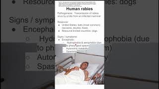 Human rabies