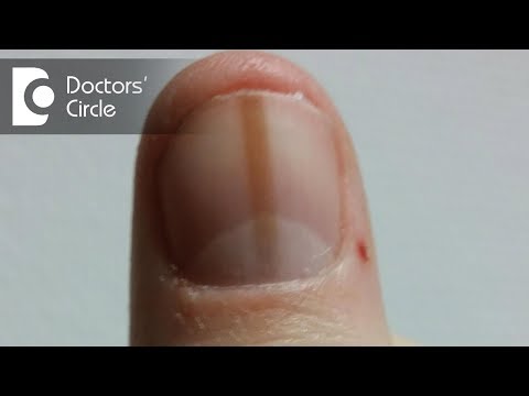 What can cause red thick line beneath the thumbnail? - Dr. Aruna Prasad