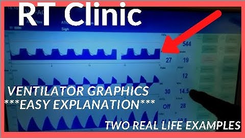RT Clinic: Ventilator Waveform Graphics - Easy Explanation - Real Examples