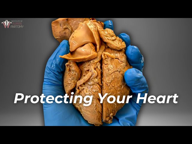 The Worst Kind of Heart Disease & How to Prevent It class=