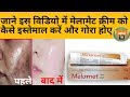 Melamet cream पाएँ प्राकृतिक बेदाग गोरापन ।get natural fairness full review hindi में