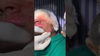 Vitiligo Surgery Happy Patient Review Story Skinaa Clinic Viral 