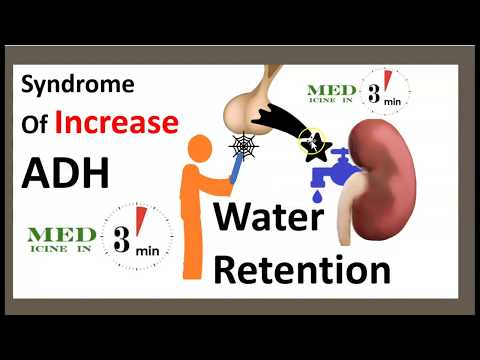 2-Minute Medicine: SIADH