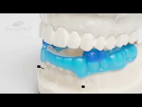 SomnoDent Morning Repositioner - Oral Appliance Bite Deprogrammer