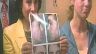 Famous a very extreme Extreme Makeover Profile