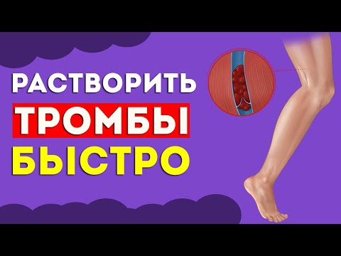 ЭТИ продукты БЫСТРО растворяют ТРОМБЫ в сосудах  Тромбоэмболия, варикоз, профилактика тромбоза