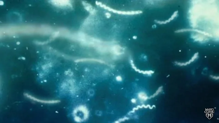 Mayo Clinic Minute: Concerning rise in syphilis cases across Minnesota