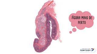 Histologia Módulo 6 - Tonsilas, Placa de Peyer...