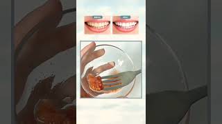 خلطة كورية لتبييض الاسنان ، skincareroutine teeth koreanexercise freefire